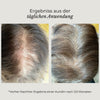 Azerum Kopfhautserum für sichtbar dichteres Haar, Flasche mit Applikator, auf weißem Hintergrund.