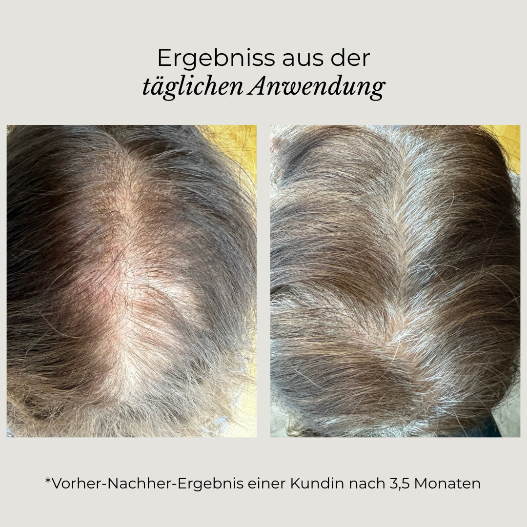 Azerum Kopfhautserum für sichtbar dichteres Haar, Flasche mit Applikator, auf weißem Hintergrund.