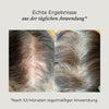 Vorher-Nachher-Bild des AZERUM Kopfhautserums für sichtbar dichteres Haar, zeigt Haarverdichtung und gesunde Kopfhaut