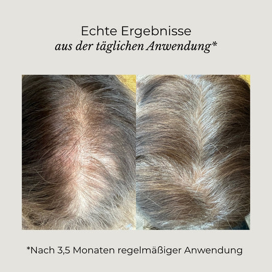 Azerum - Kopfhautserum für sichtbar dichteres Haar