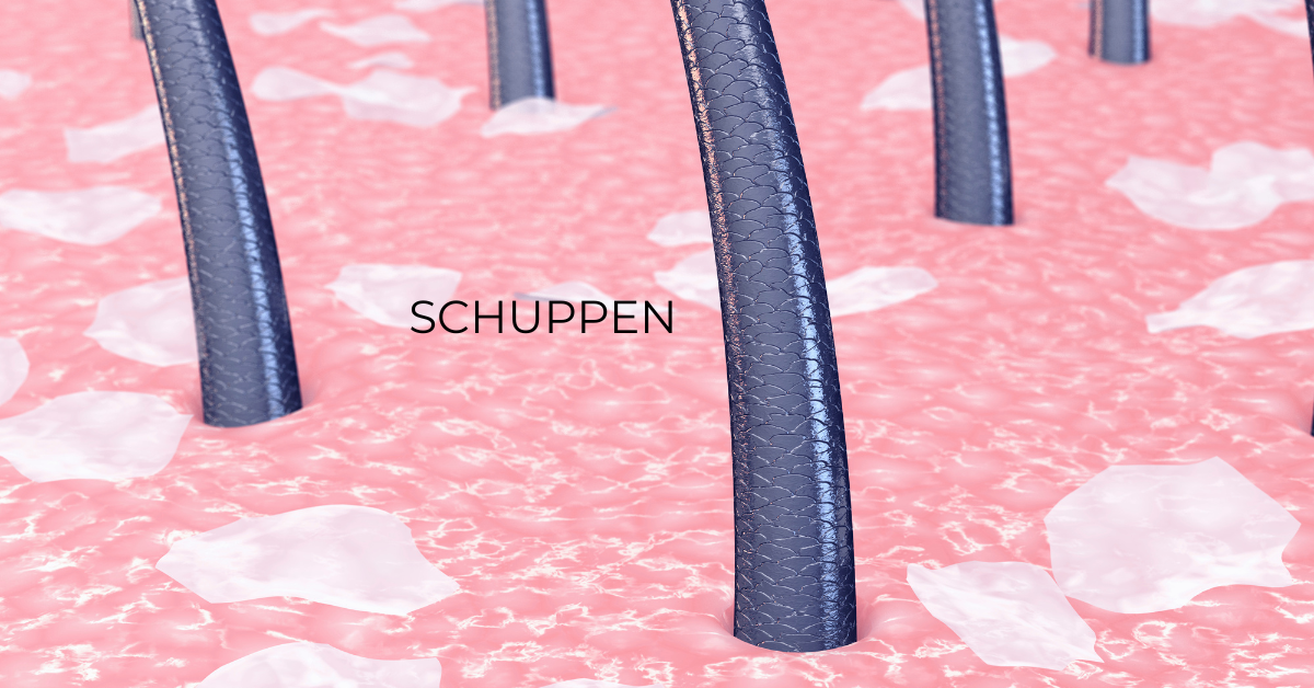Schuppen | Dandruff