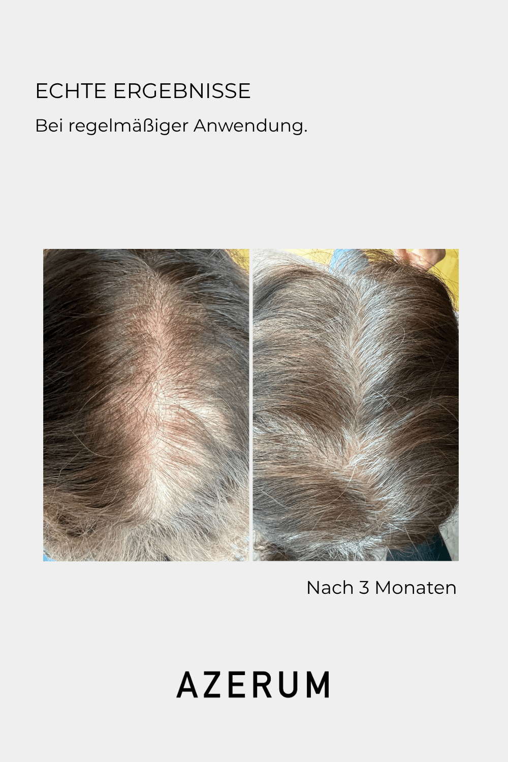 Azerum hair serum 100 ml 4 Azerum hair serum 100 ml - Image 4