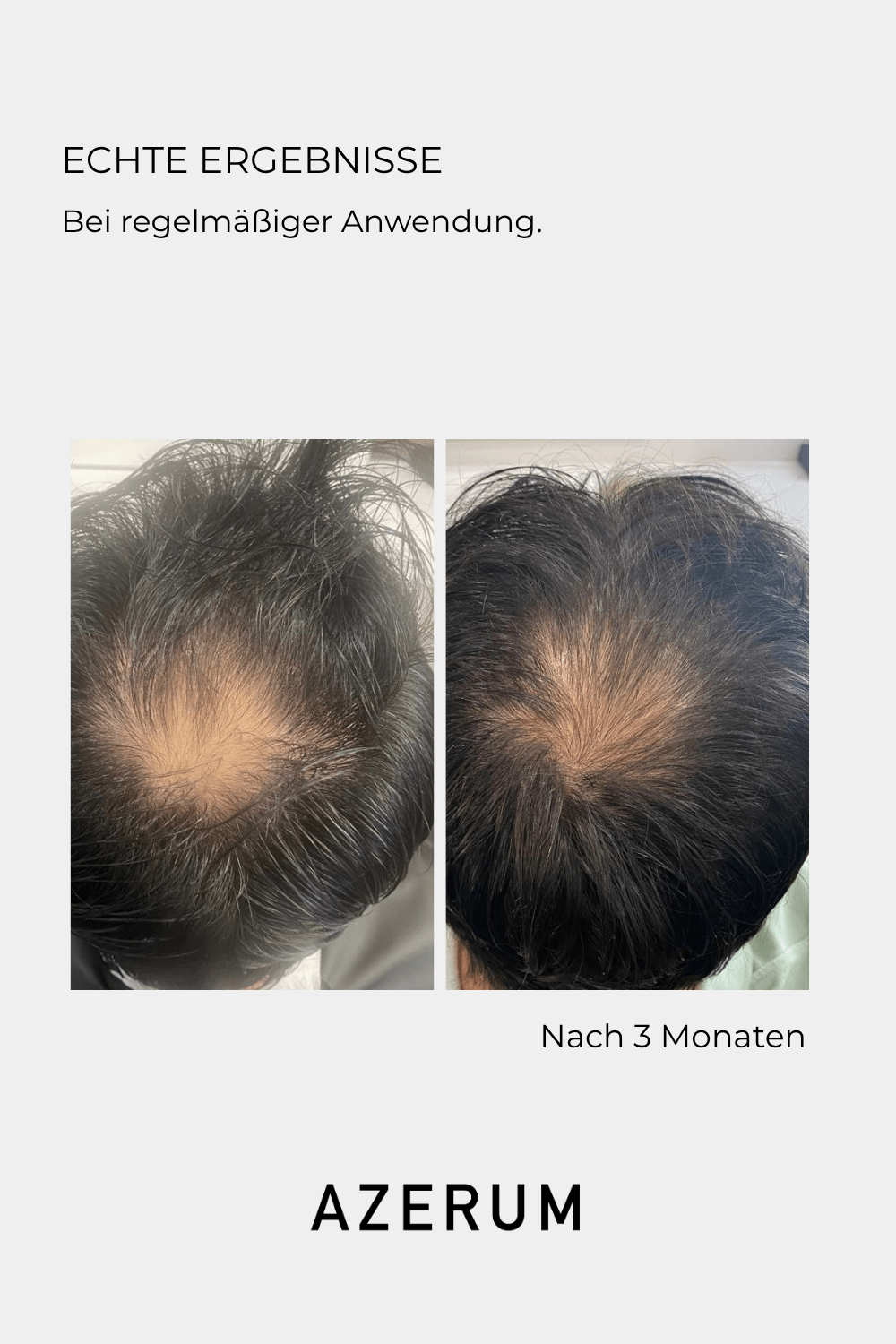 Azerum hair serum 100 ml 6 Azerum hair serum 100 ml - Image 6