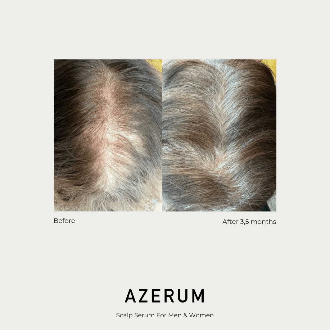 Azerum hair serum 200 ml 4 Azerum hair serum 200 ml - Image 4