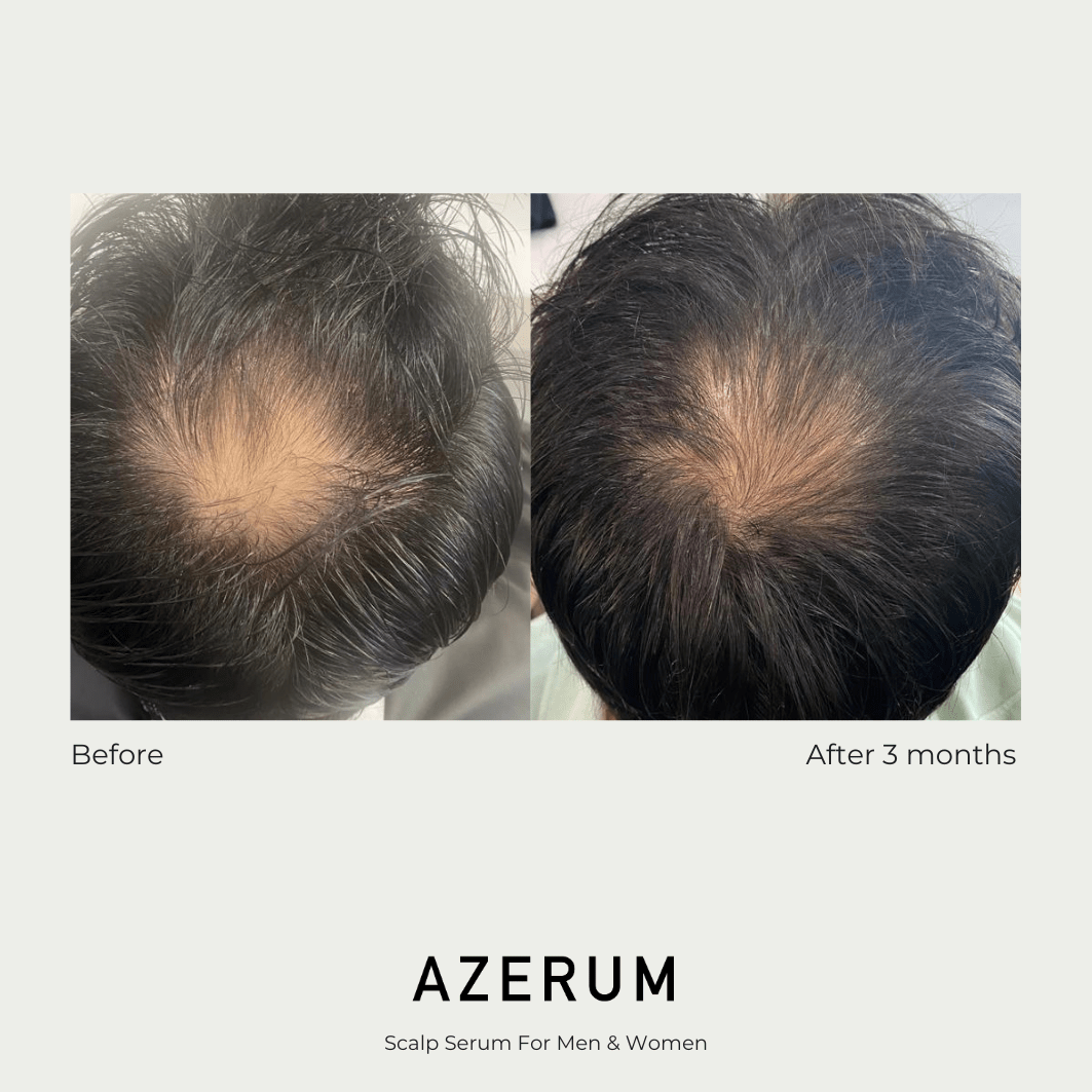 Azerum hair serum 200 ml 5 Azerum hair serum 200 ml - Image 5