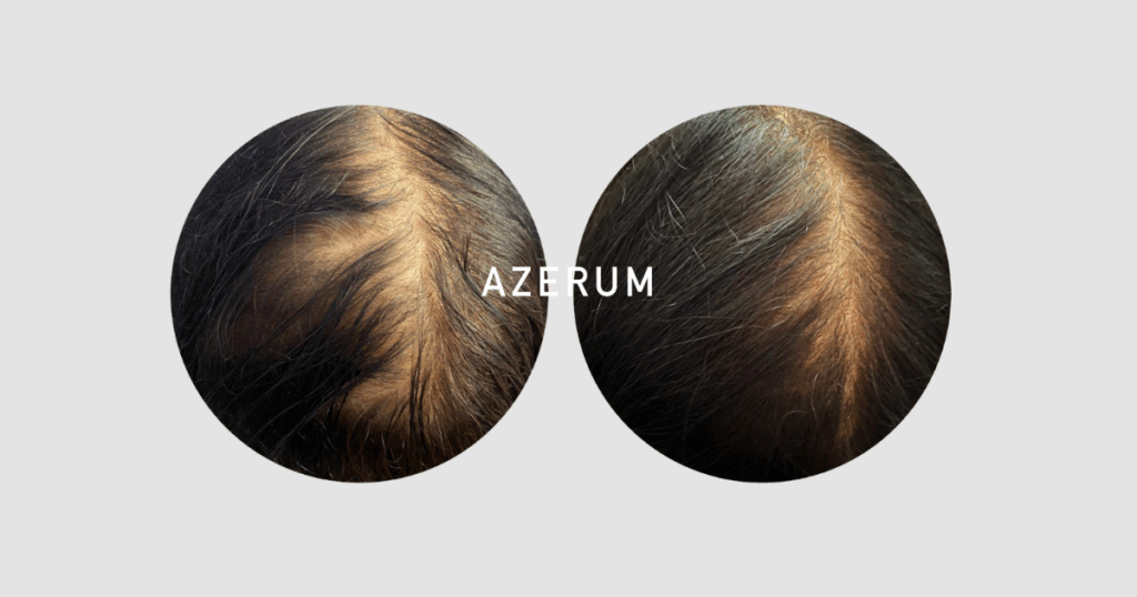 Produktbilder Shop 1200 x 630 px 2 1